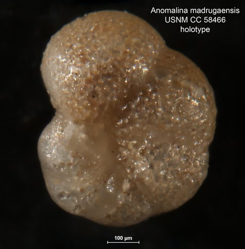 Anomalina madrugaensis Cushman & Bermudez, 1948