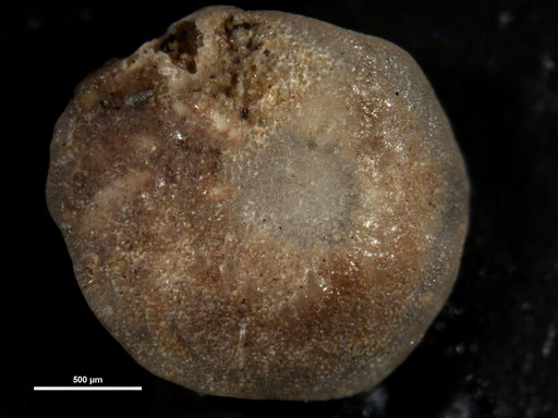 Amphistegina canaensis Bermúdez, 1949