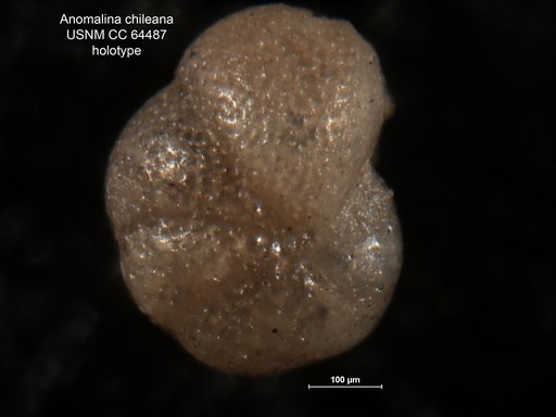 Anomalina chileana Todd & Kniker, 1952