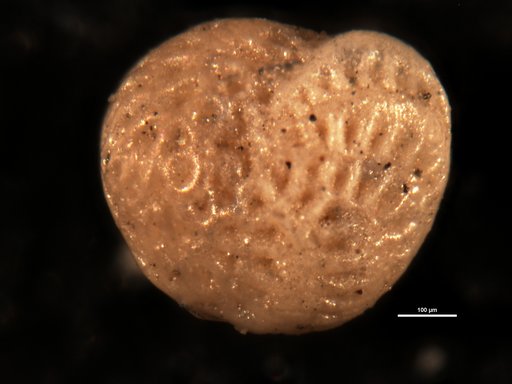 Elphidium patagonicum Todd & Kniker, 1952