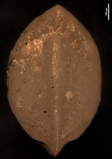 Robulus abuillotensis Bermudez, 1949