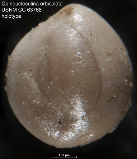 Quinqueloculina orbiculata Cushman & Stainforth, 1951