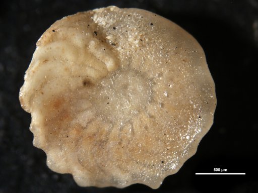 Amphistegina canaensis Bermúdez, 1949