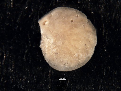 Amphistegina bikiniensis Todd & Post, 1954