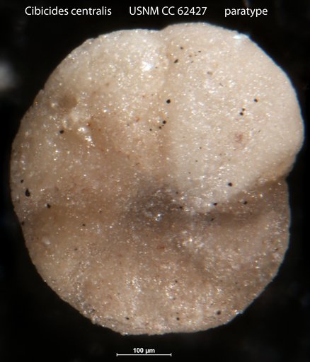 Cibicides centralis Bermúdez, 1949