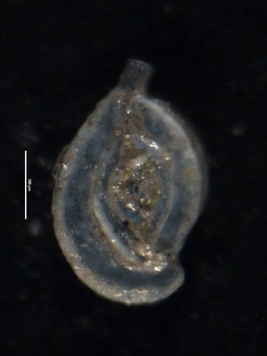 Spiroloculina anderseni Todd & Brönnimann, 1957