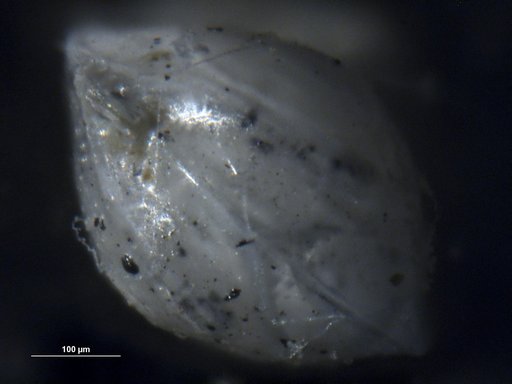 Robulus intus-vortex Bermudez, 1949