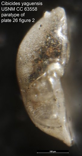 Cibicides yaquensis Bermúdez, 1949
