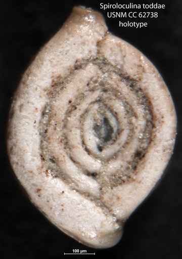 Spiroloculina toddae Bermúdez, 1949