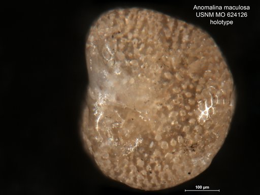 Anomalina ? maculosa Todd, 1957