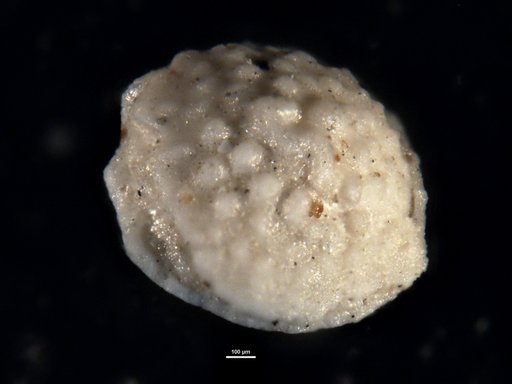 Amphistegina alabamensis Applin & Jordan, 1945