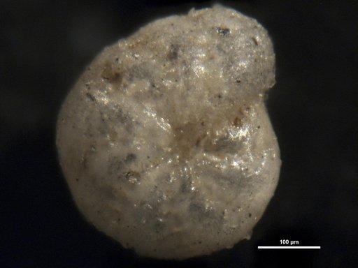Elphidium chilenum Todd & Kniker, 1952