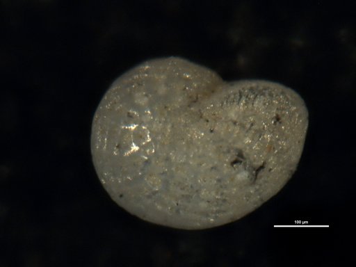 Elphidium hyalocostatum Todd, 1957