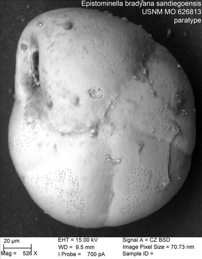 Epistominella bradyana sandiegoensis Uchio, 1960