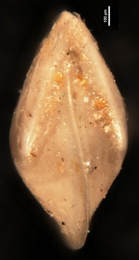 Robulus arcuato-striatus var. carolinianus Cushman, 1933