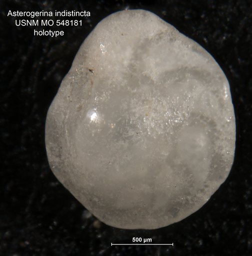 Asterigerina indistincta Todd & Post, 1954