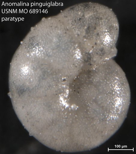 Anomalina pinguiglabra Finlay, 1940