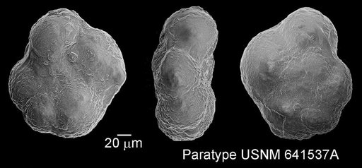 Hedbergella beegumensis Marianos & Zingula, 1966