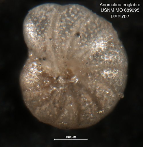 Anomalina eoglabra Finlay, 1940