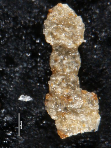 Ammobaculites gutschicki Conkin, 1961