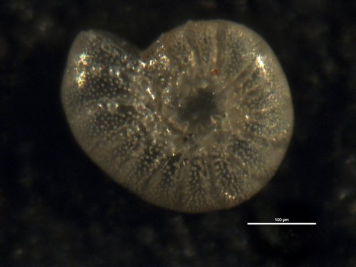 Elphidium ? ellisi Weiss, 1954