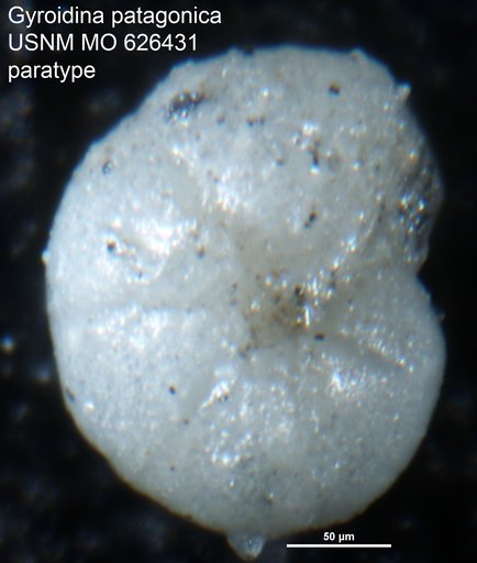 Gyroidina patagonica Camacho, 1954