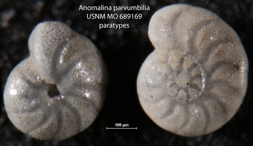 Anomalina parvumbilia Finlay, 1940