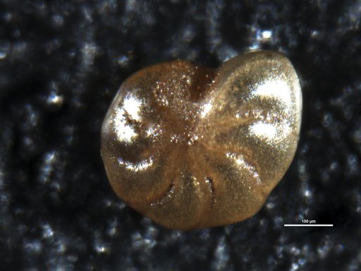 Elphidium ? ustulatum Todd, 1957