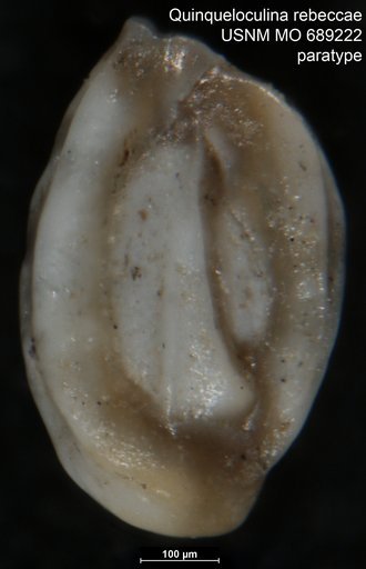 Quinqueloculina (Lachlanella) rebeccae Vella, 1957