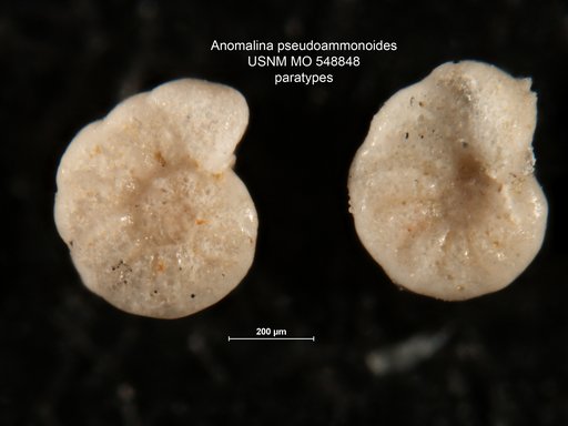 Anomalina pseudoammonoides McLean, 1953