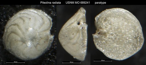 Pileolina radiata Vella, 1957