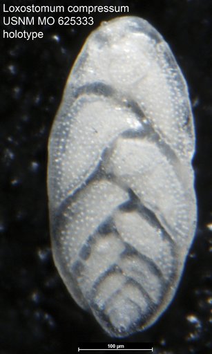 Loxostomum compressum LeRoy, 1964