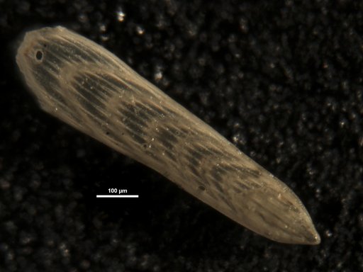 Plectofrondicularia pellucida Finlay, 1939