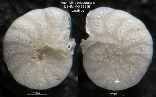 Anomalina miosuturalis Finlay, 1940