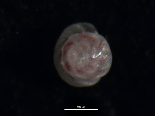 Ammonia jacksoni Buzas et al., 1977