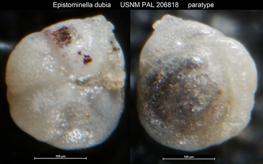 Epistominella dubia Haque, 1956