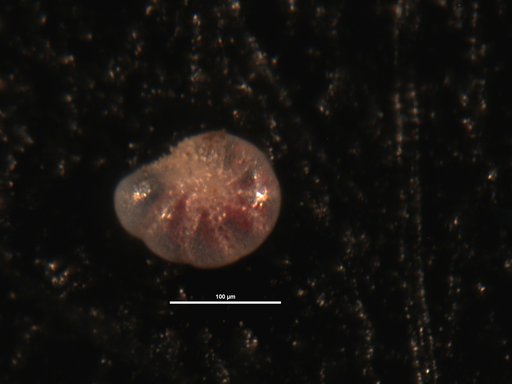 Elphidium norvangi Buzas et al., 1977
