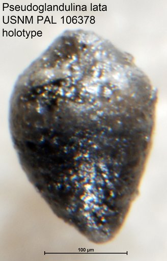 Pseudoglandulina lata Tappan Loeblich, 1951