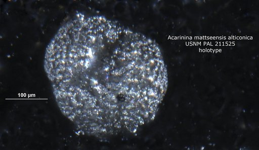 Acarinina mattseensis alticonica Fleisher, 1974