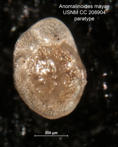 Anomalinoides mayae Bermúdez, 1963