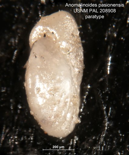 Anomalinoides pasionensis Bermúdez, 1963