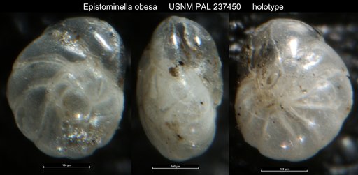 Epistominella obesa Bandy & Arnal, 1957