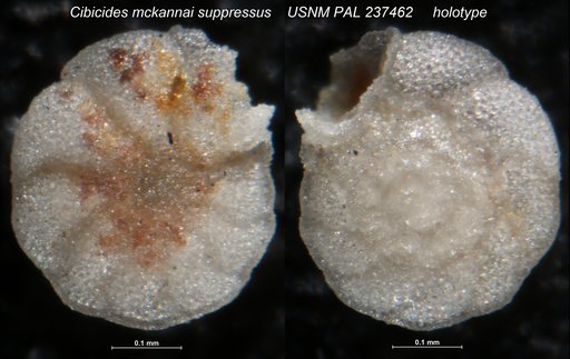 Cibicides mckannai suppressus Martin, 1952