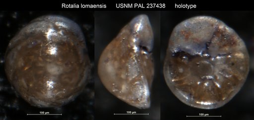 Rotalia lomaensis Bandy, 1953