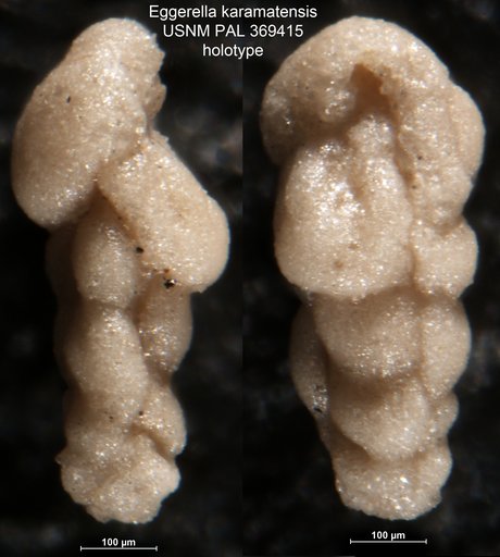 Eggerella karamatensis Brönnimann, 1953