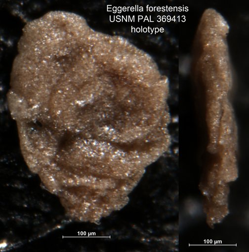 Eggerella forestensis Brönnimann, 1953
