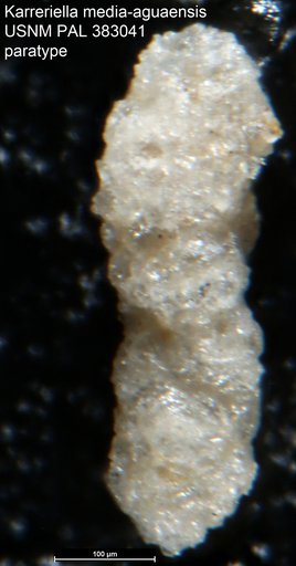 Karreriella media-aguaensis Mallory, 1959