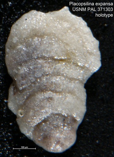 Placopsilina expansa Tappan, 1943