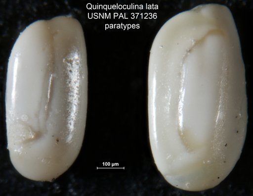 Quinqueloculina lata Terquem, 1876