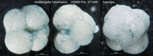 Hedbergella hiltermanni Loeblich & Tappan, 1961